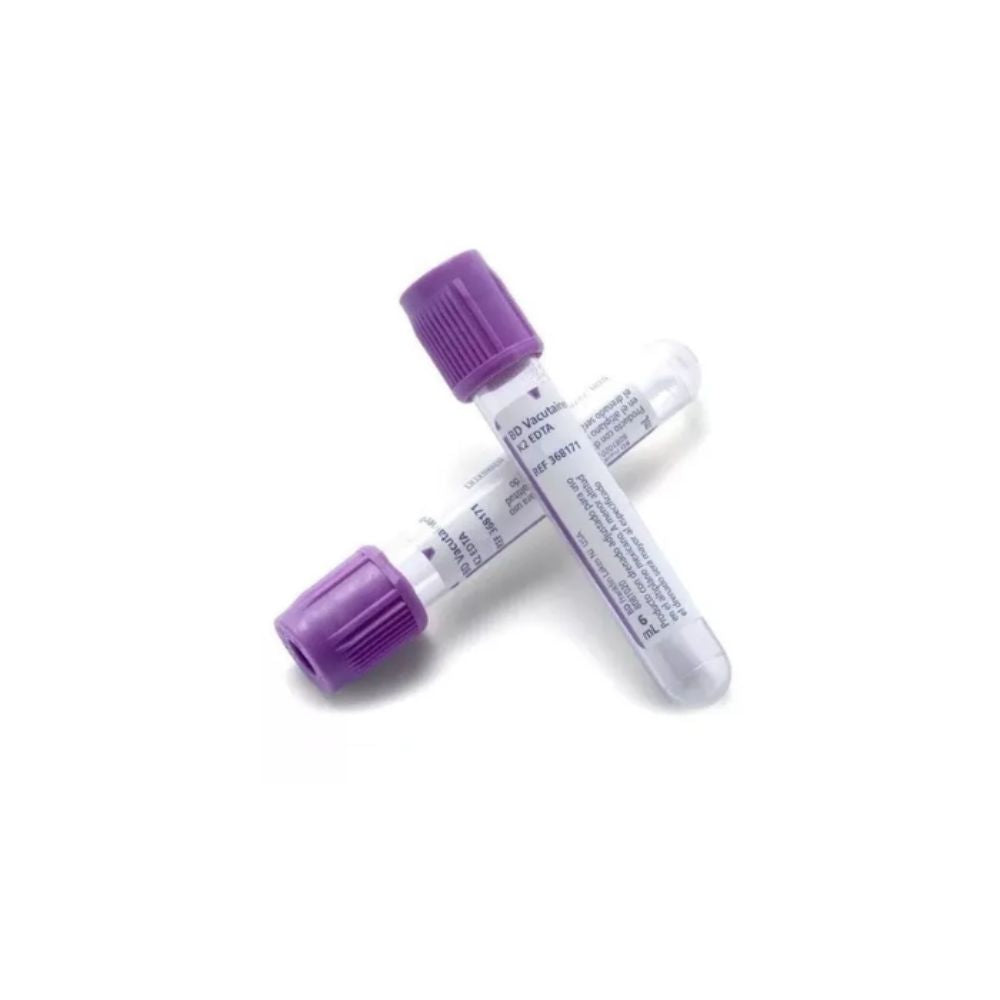 Catéter intravenoso con conectores morados y tubos transparentes